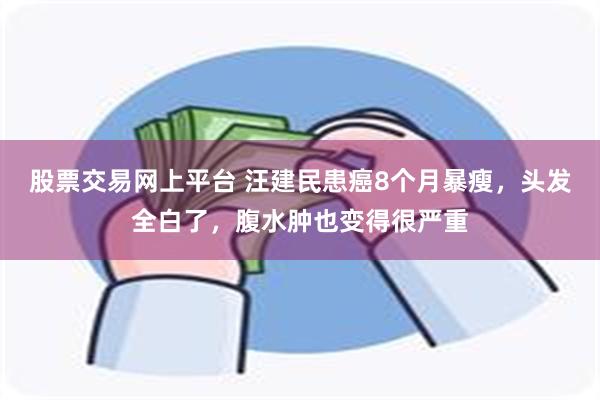 股票交易网上平台 汪建民患癌8个月暴瘦，头发全白了，腹水肿也变得很严重